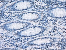 SORD / Sorbitol Dehydrogenase Antibody (clone OTI12A7)