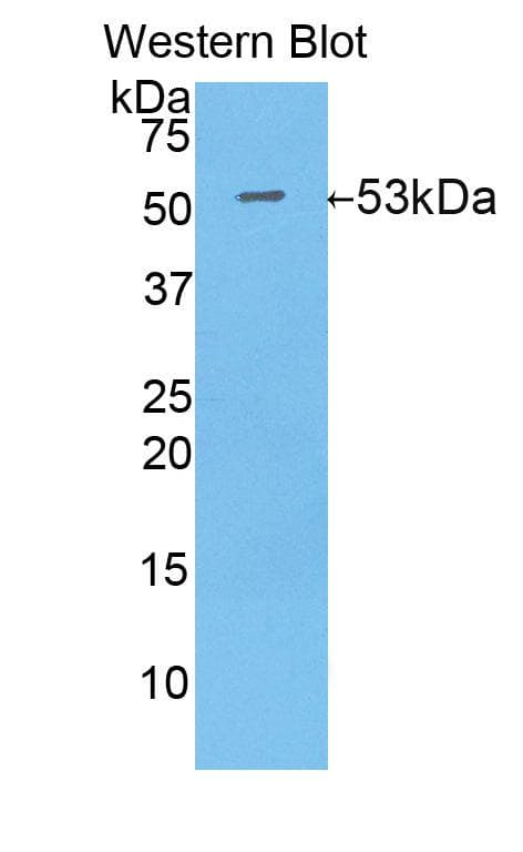 IDH1 / IDH Antibody (aa99-325, PE)