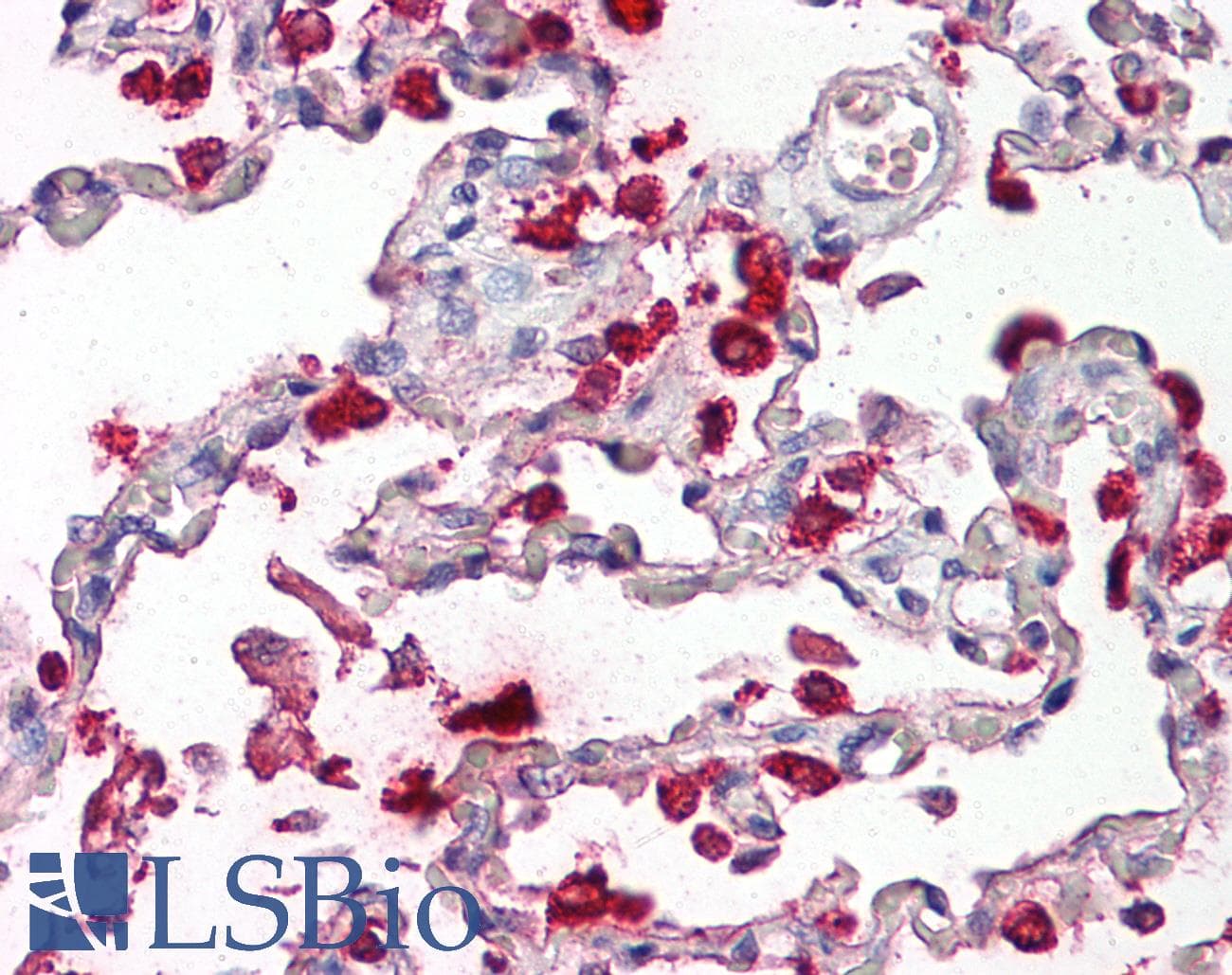 Polyclonal Rabbit anti-Human SFTPB / Surfactant Protein B Antibody (aa194-243, IHC, WB)