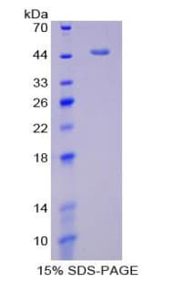 Rat SERPINE1 / PAI-1 Protein (Recombinant His-T7)