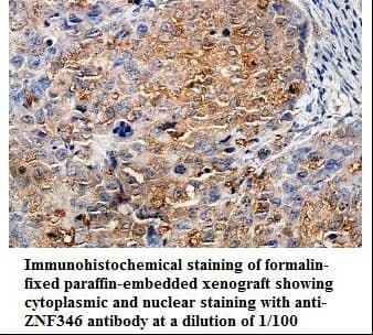 Polyclonal Rabbit anti-Human ZNF346 Antibody (aa95-289, IHC, WB)