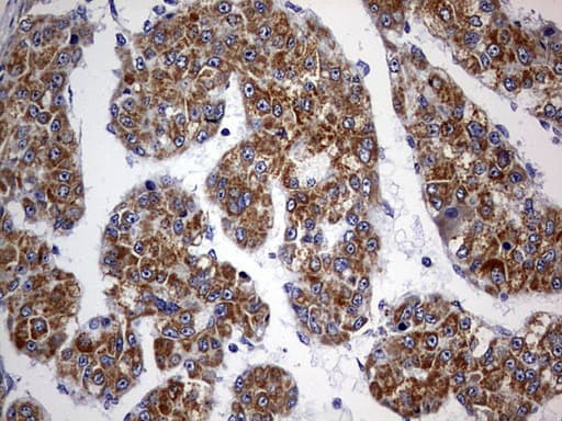 Monoclonal Mouse anti-Human OXSM / KS Antibody (clone OTI4E10, Carrier-free, aa78-343, IHC, WB)