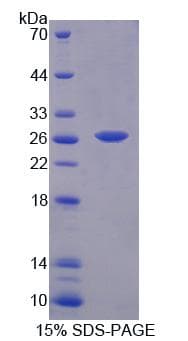 Mouse BCAT1 / ECA39 Protein (Recombinant)