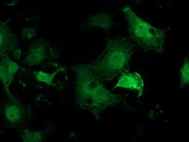 PNMT Antibody (clone OTI1F3)