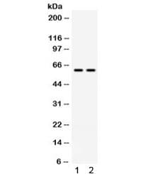 CCT3 Antibody