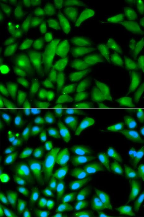 PathPlus™ PARK2 / Parkin 2 Antibody