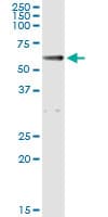 PathPlus™ ALDH1A1 / ALDH1 Antibody (clone 1G6)