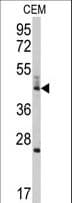 BCL2L13 / Bcl Rambo Antibody (aa197-225)