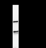 Monoclonal Mouse anti-Human ZW10 Antibody (clone 3363C4a, IF, WB)