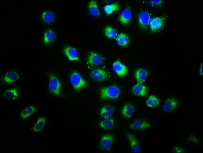 DVL2 / Dishevelled 2 Antibody (aa1-240)