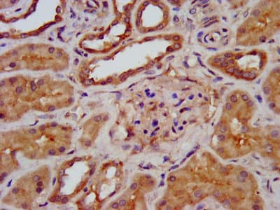 Polyclonal Rabbit anti-Human TRIM8 / GERP Antibody (IF)