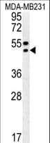 TRAM2 Antibody (aa342-370)