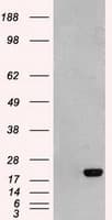 AK1 / Adenylate Kinase 1 Antibody (clone OTI5G8)