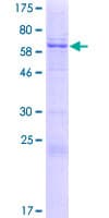 Human VIPERIN / RSAD2 Protein (Recombinant GST)