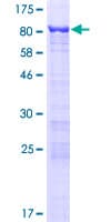 Human GNL3L Protein (Recombinant GST)