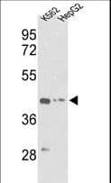 IHC-plus™ ACTG1 / Gamma Actin Antibody (aa188-215)