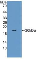 Pig KITLG / SCF Protein (Recombinant His, N-Terminal)