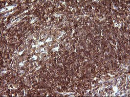 CHAF1B / CAF1 Antibody (clone OTI4F7)