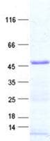 Human MOK / RAGE Protein (Recombinant His, N-Terminal)