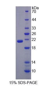 Mouse EPRS / PARS Protein (Recombinant His-T7, N-terminus)