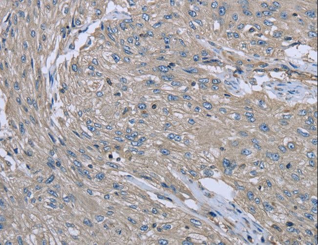 Polyclonal Rabbit anti-Human EZR / Ezrin Antibody (IHC, WB)