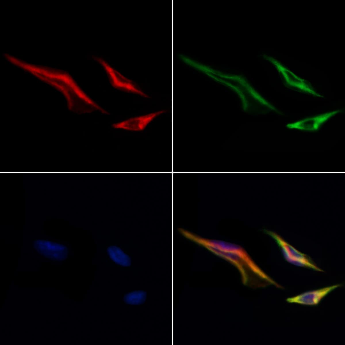 MTCH2 Antibody