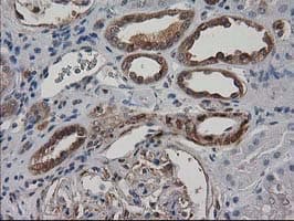 DSTN / Destrin Antibody (clone OTI1D8)