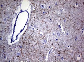 NF-L / NEFL Antibody (clone OTI3G2)