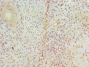 Polyclonal Rabbit anti-Human GAD1 / GAD67 Antibody (aa1-200, IHC, WB)