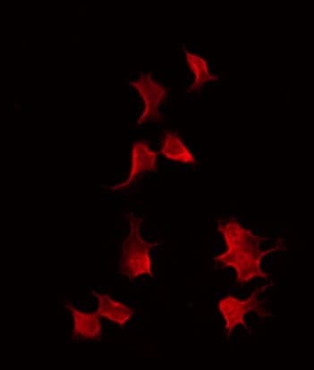 TRMT11 Antibody