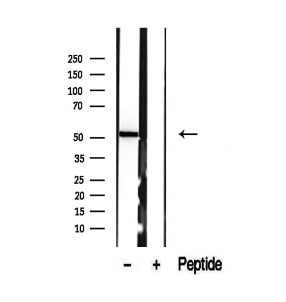 Polyclonal Rabbit anti-Human SUOX / Sulfite Oxidase Antibody (IHC, IF, WB)