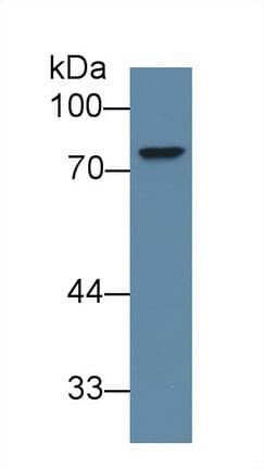 ABCD2 / ALDR Antibody