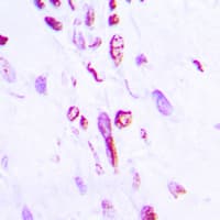 Histone H2B Antibody (Acetyl-Lys5)