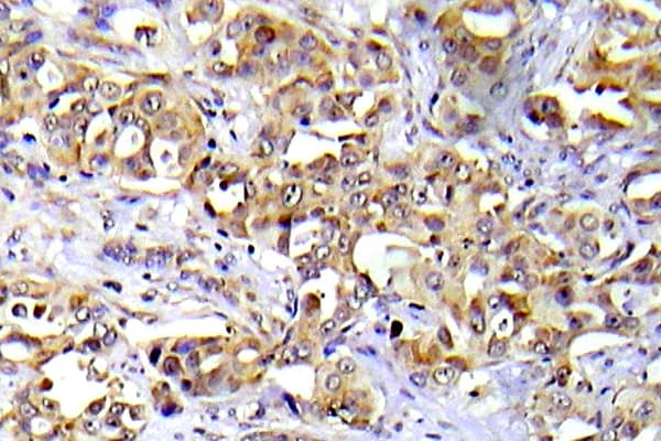 ATM Antibody (Ile1987)