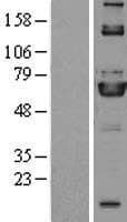 ME3 Protein (Over-Expression Lysate Myc-DDK (Flag))