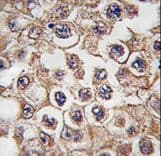 INSRR Antibody (aa16-47)