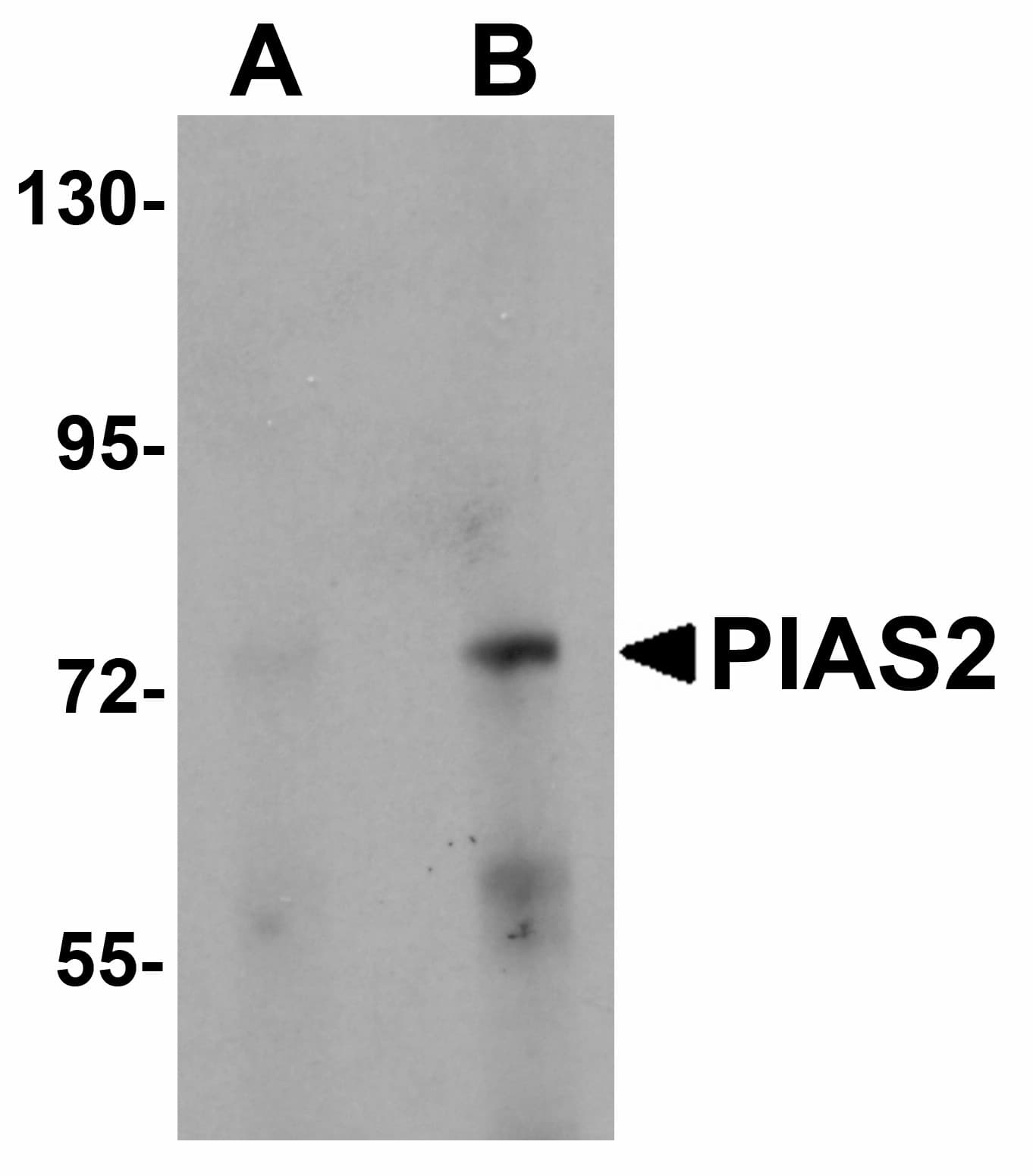 Polyclonal Rabbit anti-Human PIAS2 / PIASX Antibody (IHC, IF, WB)