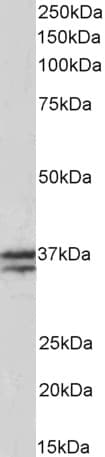 IHC-plus™ TNNT1 / TNT Antibody (aa205-218)