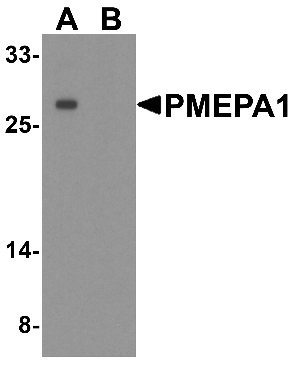 Polyclonal Rabbit anti-Human TMEPAI / PMEPA1 Antibody (IHC, WB)