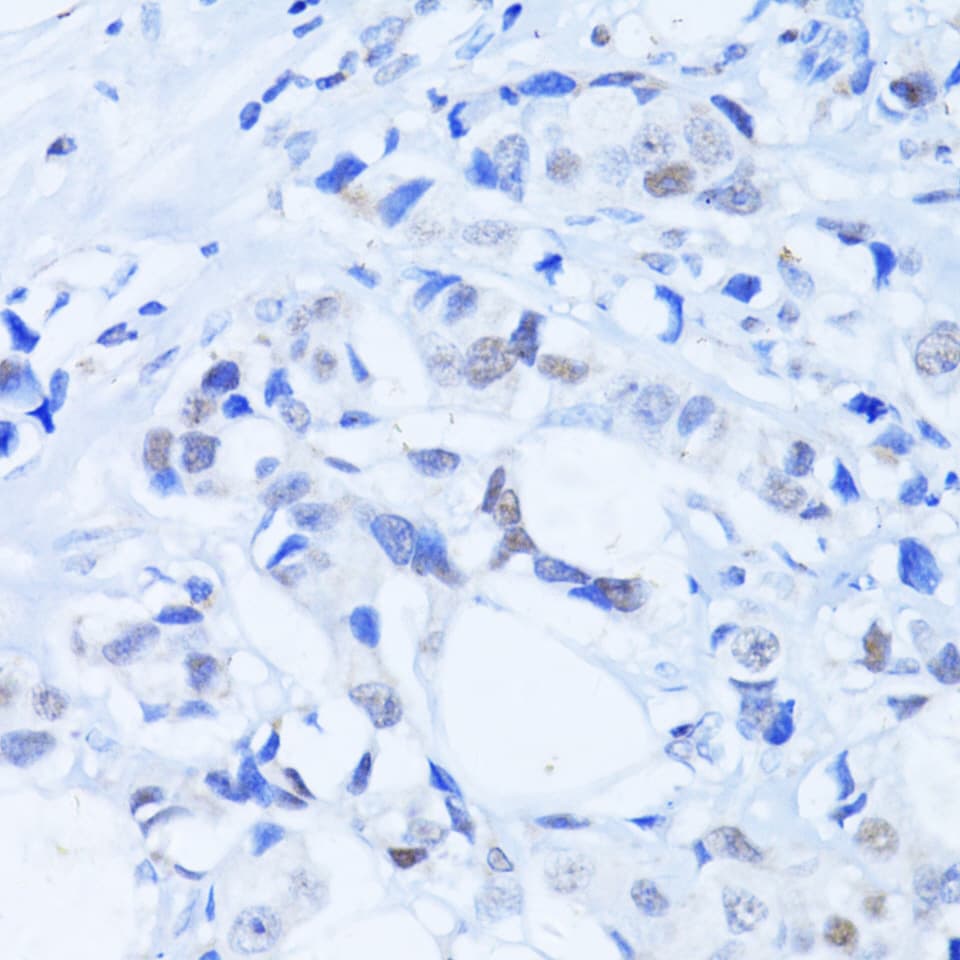 PARP1 Antibody