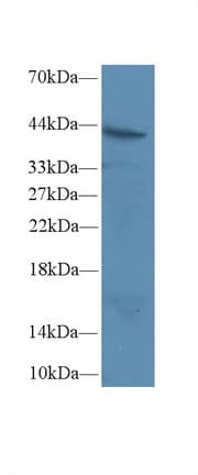 CD95 / FAS Antibody (aa21-170, PE)