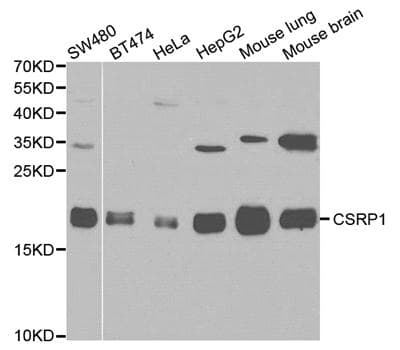 Polyclonal Rabbit anti-Human CSRP1 Antibody (IHC, IF, WB)