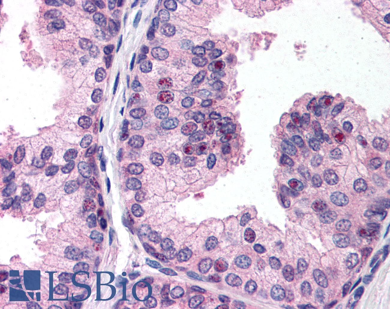 IHC-plus™ PHF2 Antibody
