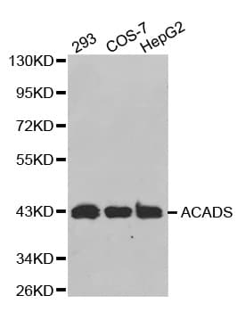 SCAD / ACADS Antibody