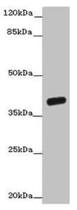 Polyclonal Rabbit anti-Human OGFOD2 Antibody