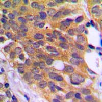 EEF2K Antibody (phospho-Ser366)
