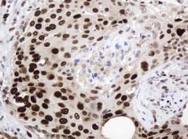 PCNA Antibody (clone OTI4G3)