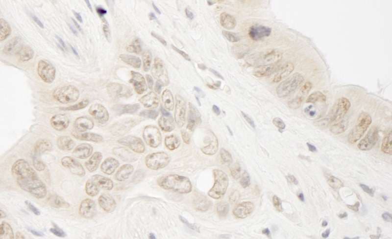 RAD54L2 Antibody (aa75-125)