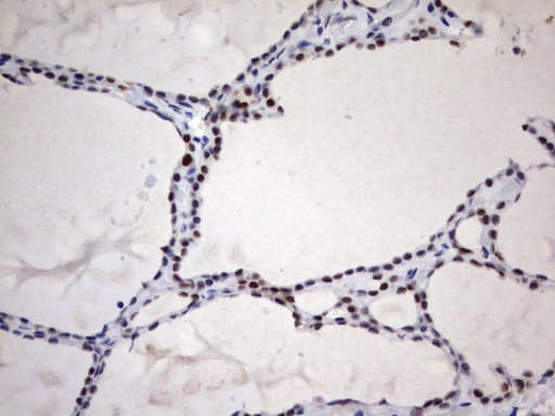 PARN Antibody (aa1-266, clone UMAB143, Carrier-free)