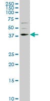 Monoclonal Mouse anti-Human NR2E1 / TLX Antibody (clone 1C4, WB)